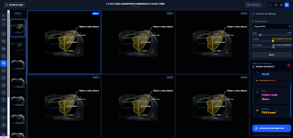 DICOM Viewer IA